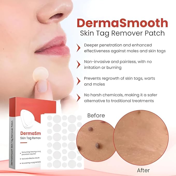 Derma Smooth Skin Tag Removal Patch Kashio Fast Acting Painless Skin Tag and Mole Remover Patch Natural Formula for Clear Smooth Skin Safe for All Skin Types